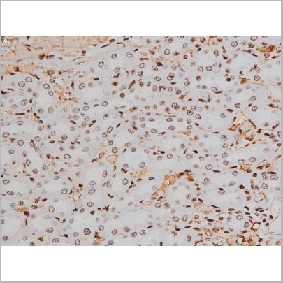 product-image-AAA31007_IHC20.jpg