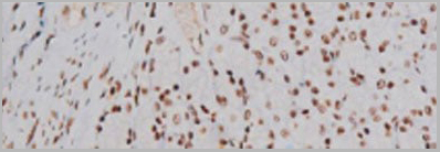 product-image-AAA31007_IHC21.jpg