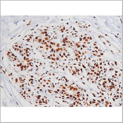 product-image-AAA31007_IHC3.jpg