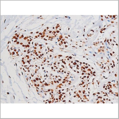 product-image-AAA31007_IHC4.jpg