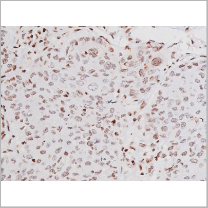 product-image-AAA31007_IHC7.jpg