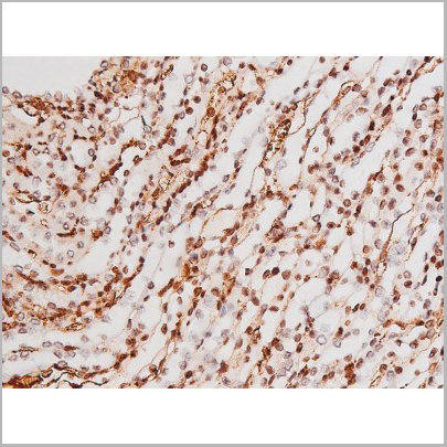 product-image-AAA31007_IHC9.jpg