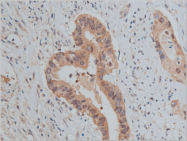 product-image-AAA31009_IHC4.jpg