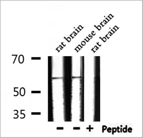 product-image-AAA31009_WB5.jpg