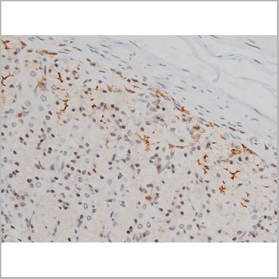 product-image-AAA31010_IHC11.jpg