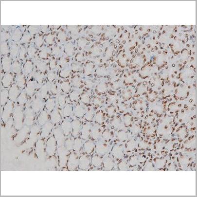 product-image-AAA31010_IHC12.jpg