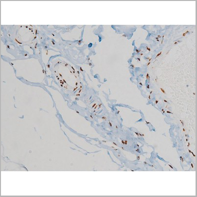 product-image-AAA31010_IHC2.jpg
