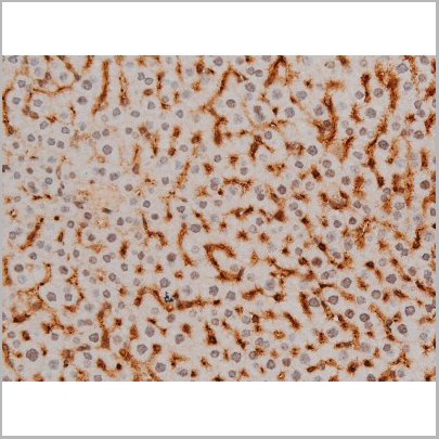 product-image-AAA31010_IHC3.jpg