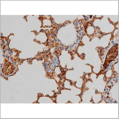 product-image-AAA31010_IHC6.jpg