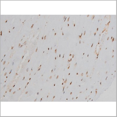 product-image-AAA31010_IHC7.jpg