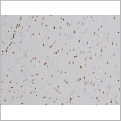 product-image-AAA31010_IHC8.jpg