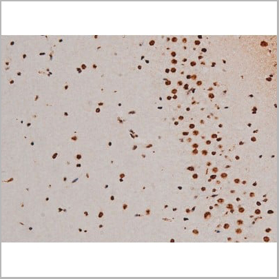 product-image-AAA31011_IHC10.jpg