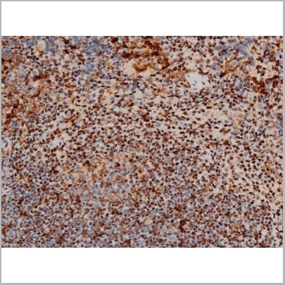 product-image-AAA31011_IHC12.jpg