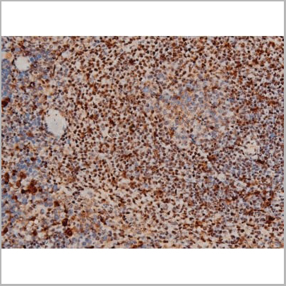 product-image-AAA31011_IHC13.jpg
