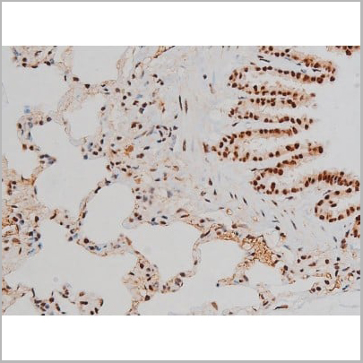 product-image-AAA31011_IHC14.jpg