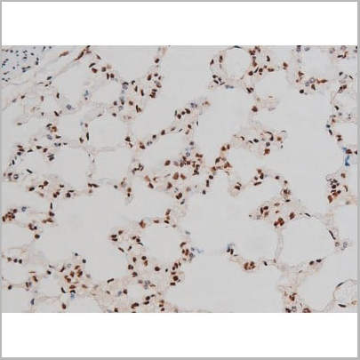 product-image-AAA31011_IHC15.jpg