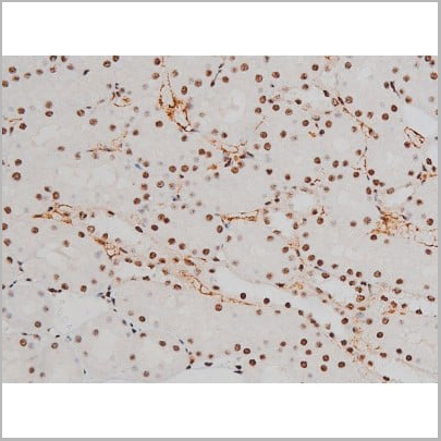 product-image-AAA31011_IHC16.jpg