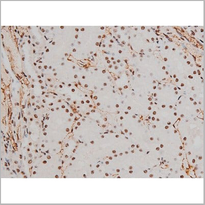 product-image-AAA31011_IHC17.jpg