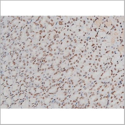 product-image-AAA31011_IHC18.jpg