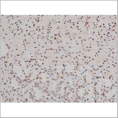 product-image-AAA31011_IHC19.jpg