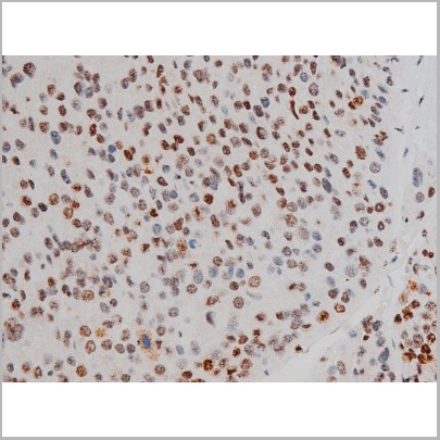 product-image-AAA31011_IHC2.jpg