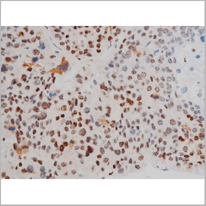 product-image-AAA31011_IHC3.jpg