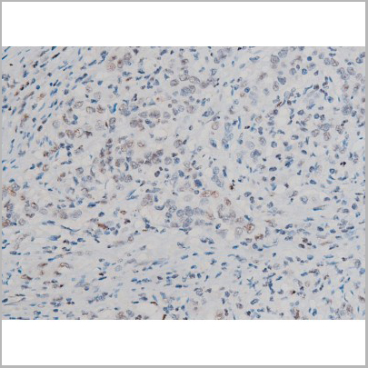 product-image-AAA31011_IHC4.jpg