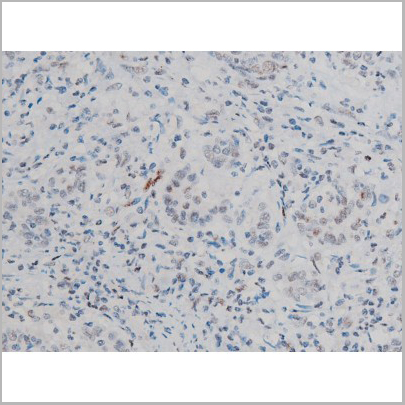 product-image-AAA31011_IHC5.jpg