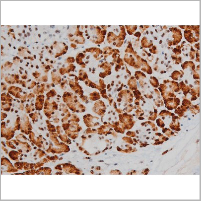 product-image-AAA31011_IHC6.jpg