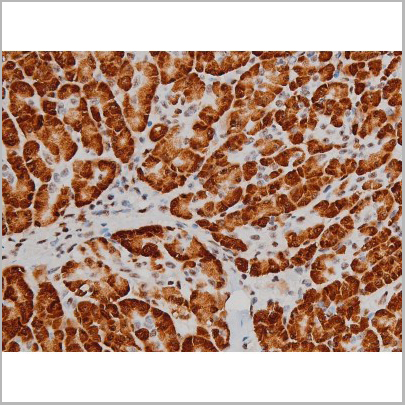 product-image-AAA31011_IHC7.jpg
