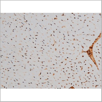 product-image-AAA31011_IHC8.jpg