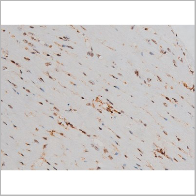 product-image-AAA31011_IHC9.jpg