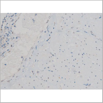 product-image-AAA31012_IHC3.jpg