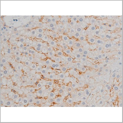 product-image-AAA31012_IHC4.jpg