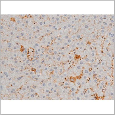 product-image-AAA31012_IHC5.jpg