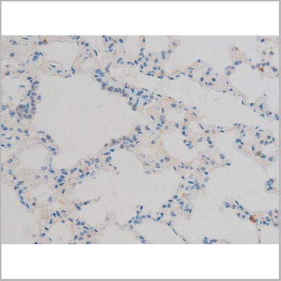 product-image-AAA31012_IHC6.jpg