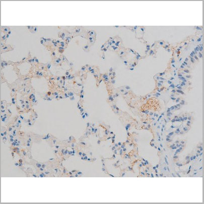 product-image-AAA31012_IHC7.jpg