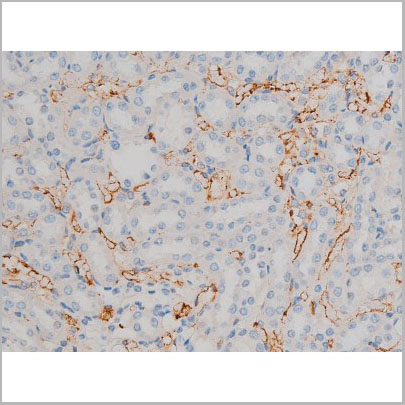 product-image-AAA31012_IHC8.jpg