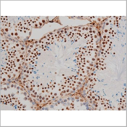 product-image-AAA31013_IHC10.jpg