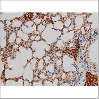 product-image-AAA31013_IHC12.jpg