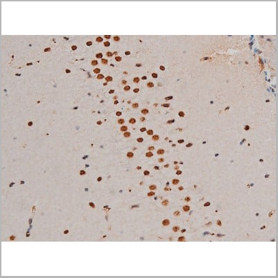 product-image-AAA31013_IHC13.jpg