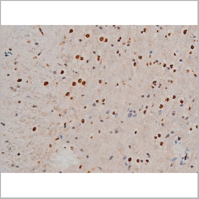 product-image-AAA31013_IHC14.jpg