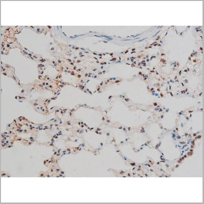 product-image-AAA31013_IHC15.jpg