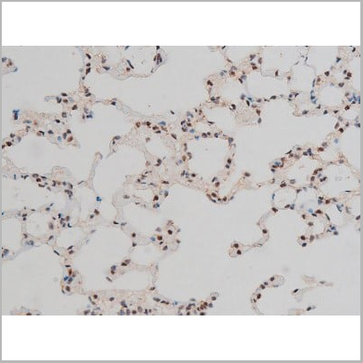 product-image-AAA31013_IHC16.jpg