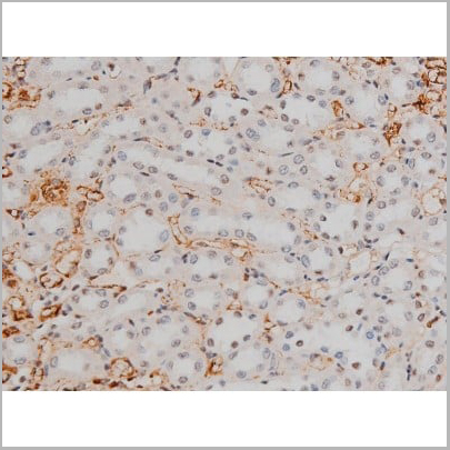 product-image-AAA31013_IHC17.jpg