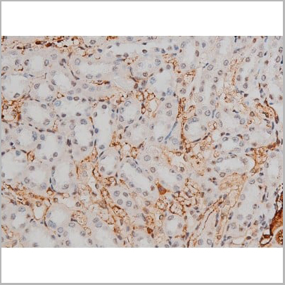 product-image-AAA31013_IHC18.jpg