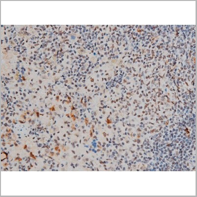 product-image-AAA31013_IHC19.jpg
