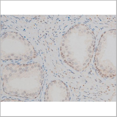 product-image-AAA31013_IHC2.jpg