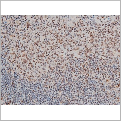 product-image-AAA31013_IHC20.jpg