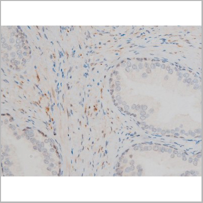 product-image-AAA31013_IHC3.jpg